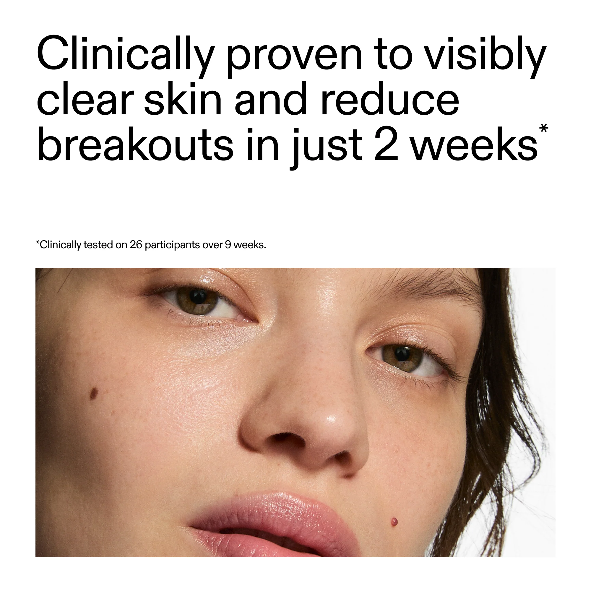 360° Acne Clearing Serum - Image 5