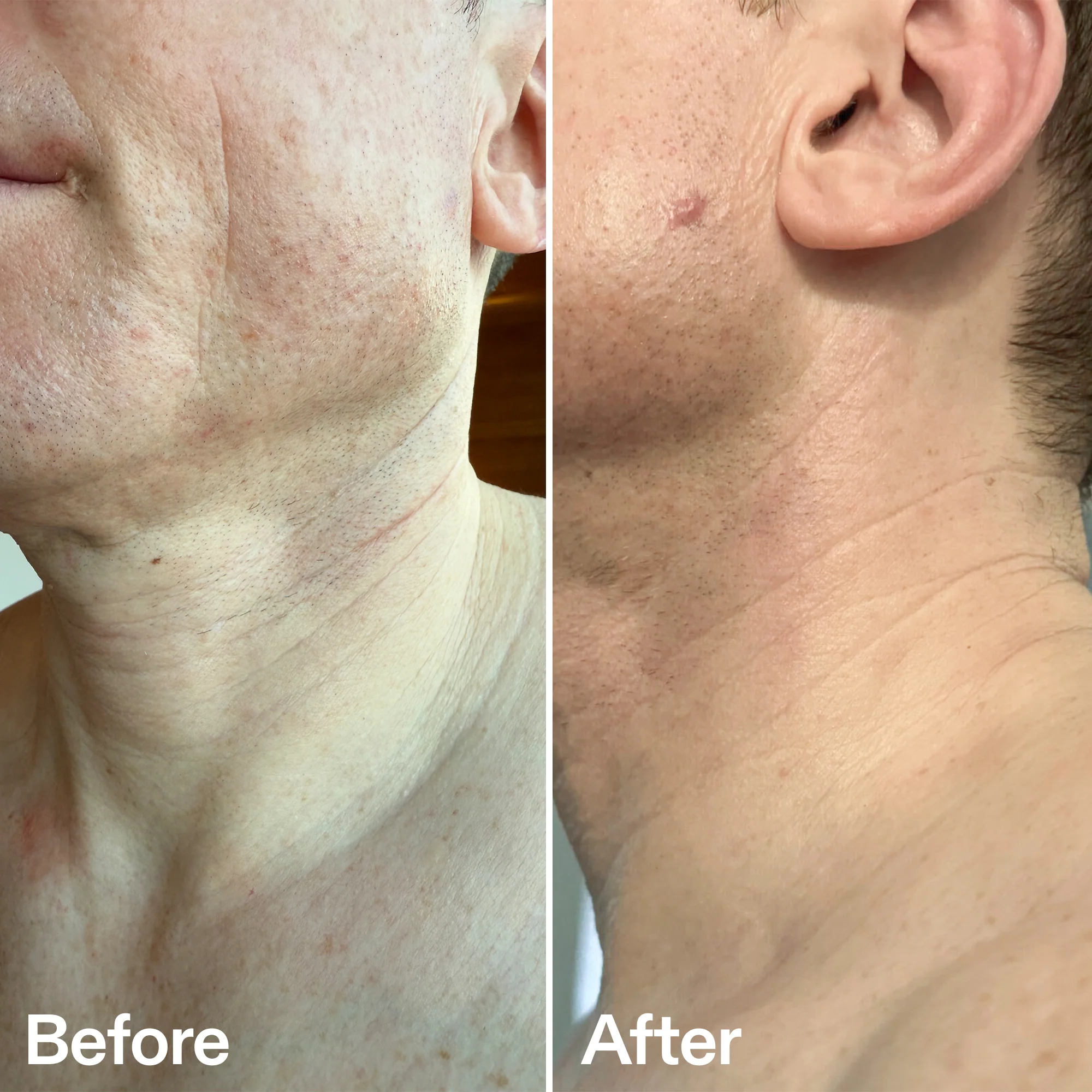 Bio-Active Neck Lift Stick - Image 7