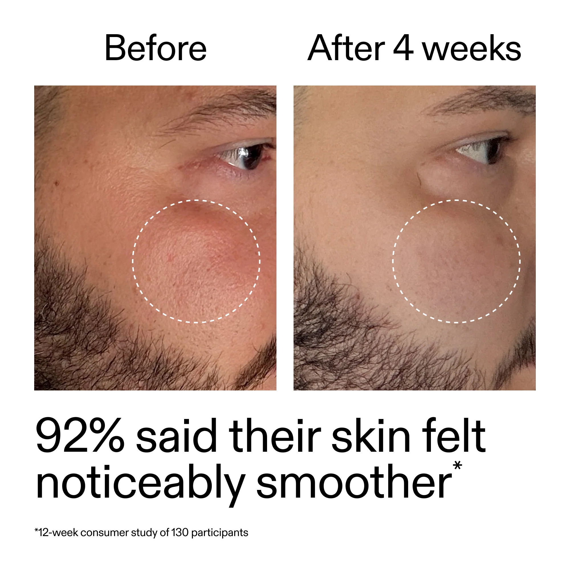 Starter Retinol Serum - Image 12
