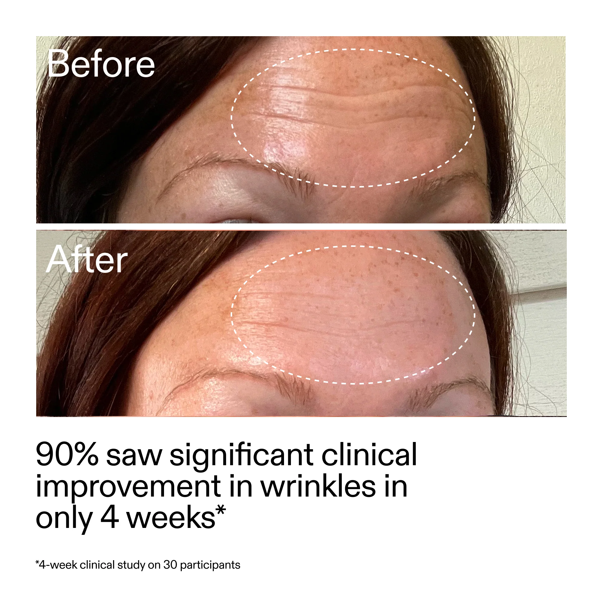 Starter Retinol Serum Duo - Image 10