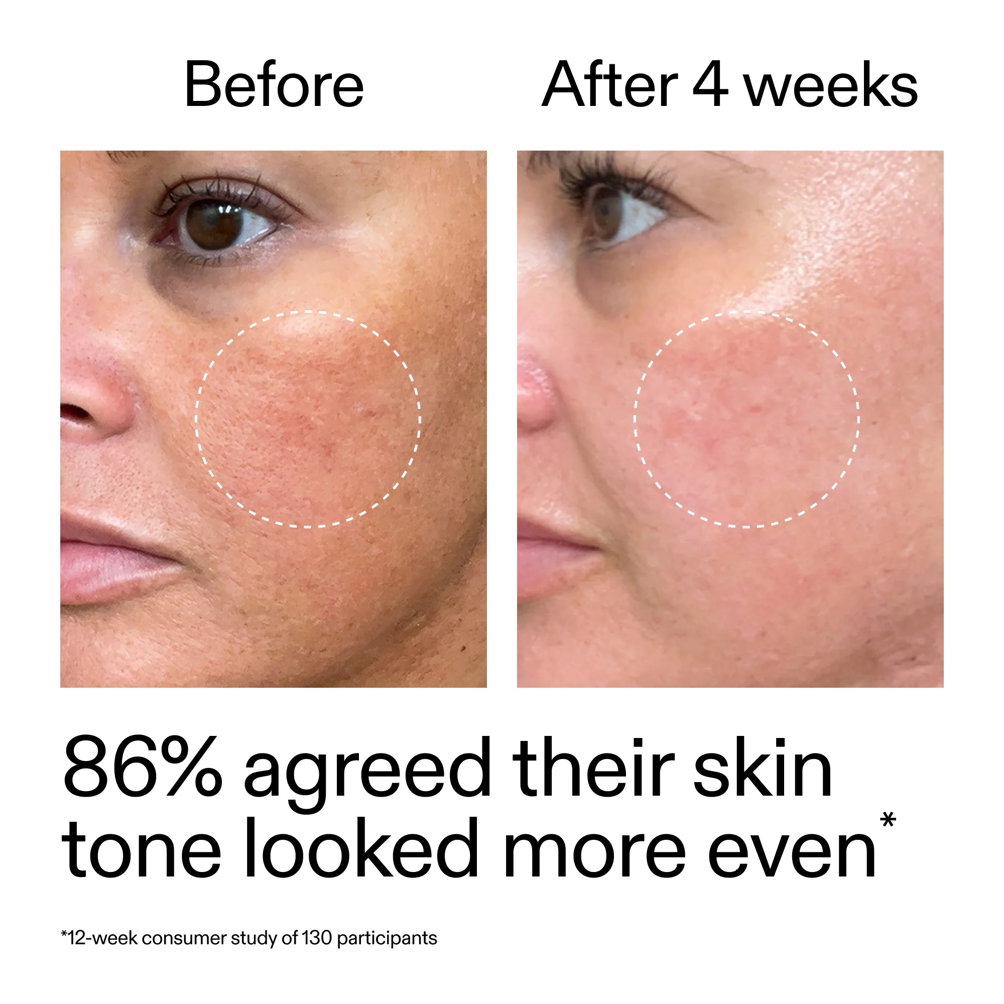 Starter Retinol Serum Duo - Image 11